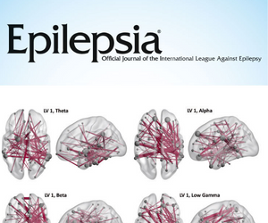 Epilepsia.jpg